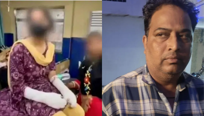 Delhi acid attack story turns out to be fake, was plotted by the girl’s father Aqeel Khan to implicate Jitendra, the husband of the woman he is accused of raping