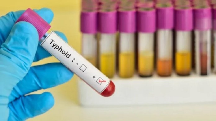 गाँधीनगर में दूषित पानी से फैला टाइडफाइड: अब तक 104 लोग अस्पताल में भर्ती, जाँच में 7 जगहों पर पाइप लाइन में मिली लीकेज